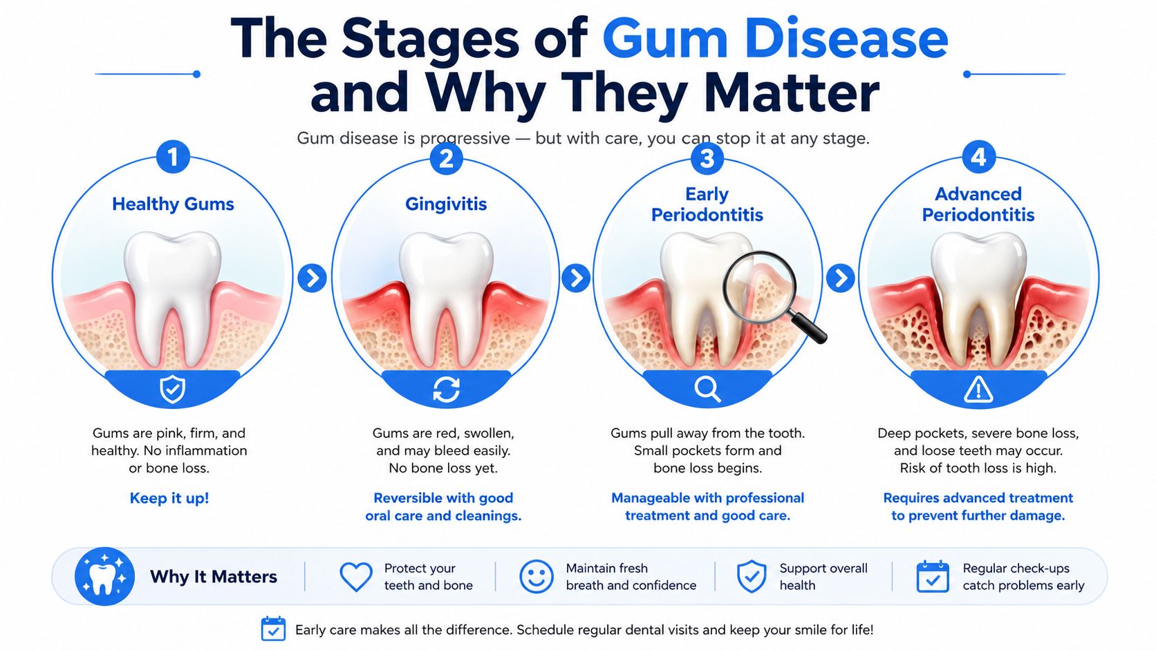 An educational infographic showing the four stages of gum disease from healthy gums to advanced periodontitis.