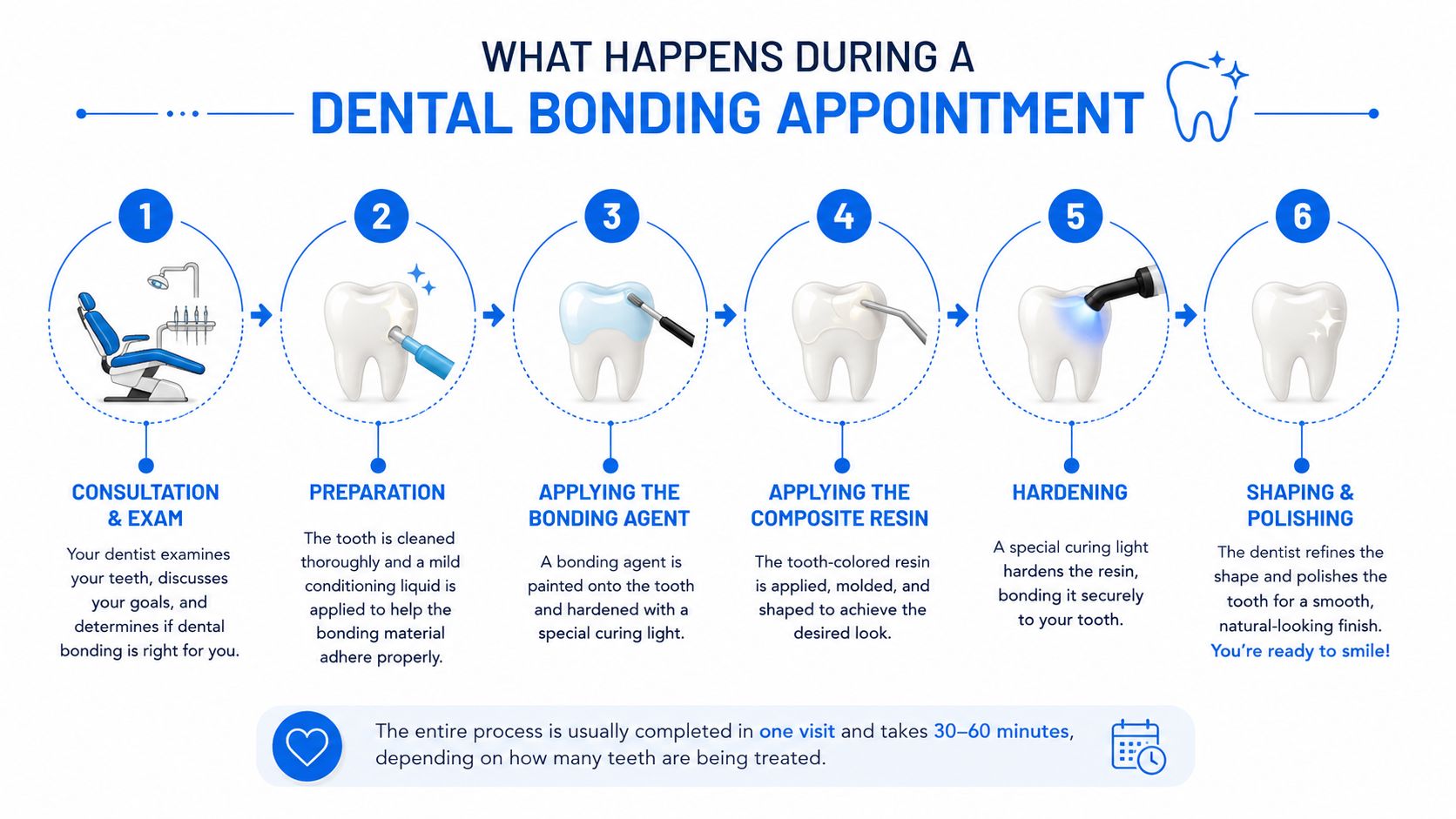An infographic showing the six step process of a dental bonding procedure for tooth restoration.