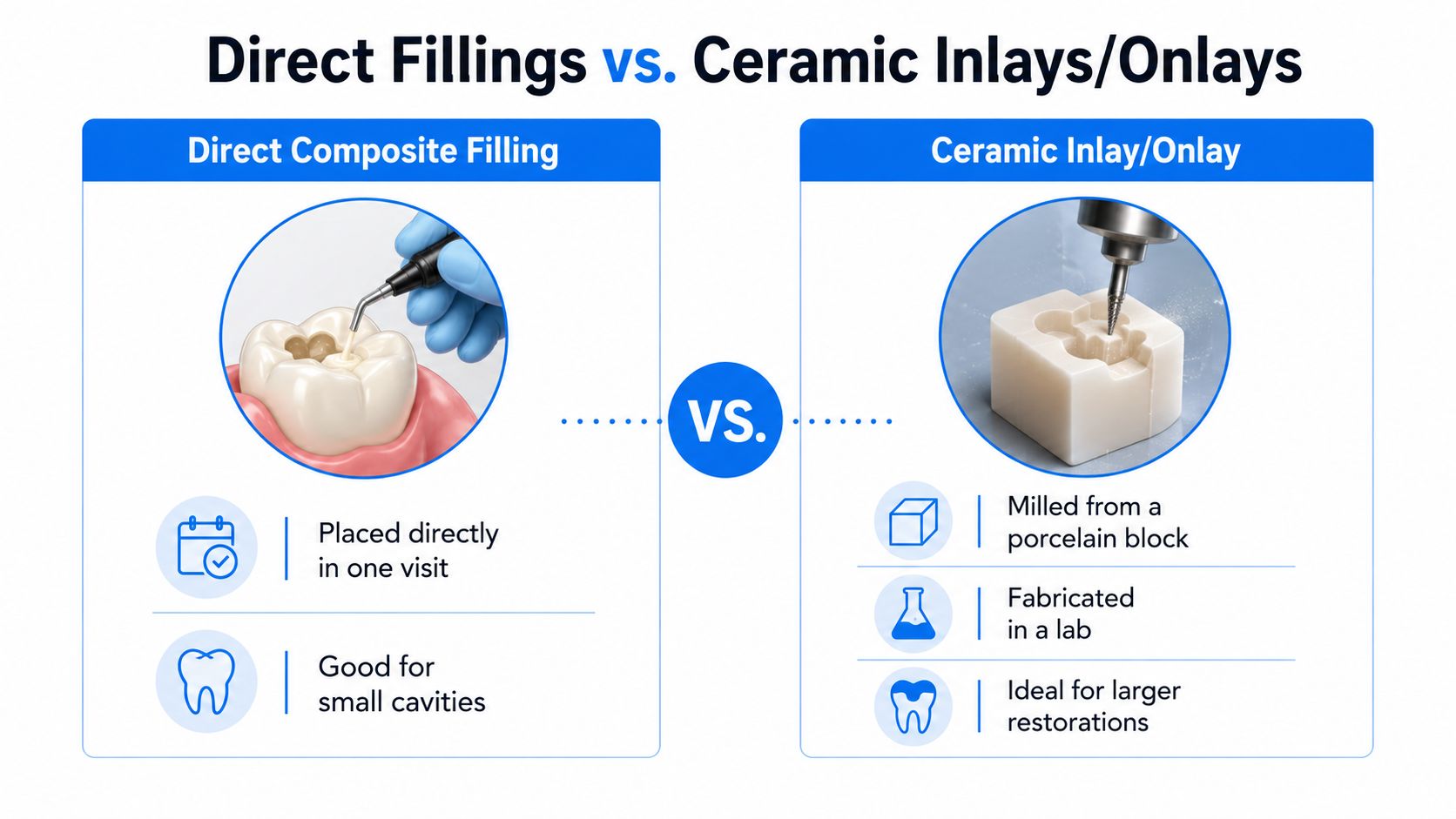 A comparison chart showing the differences between direct composite fillings and custom milled ceramic dental inlays and onlays.