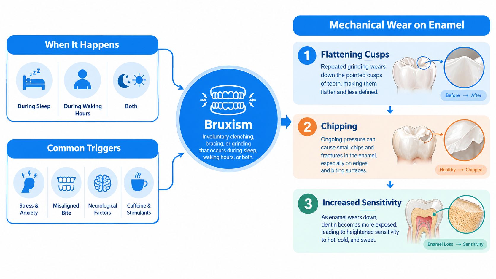 A diagram illustrating the causes, triggers, and the mechanical wear effects of bruxism on human teeth enamel.