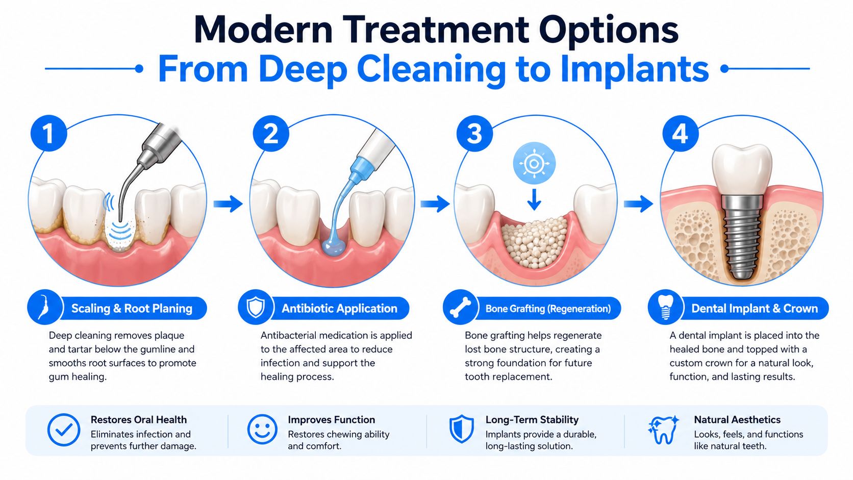 An infographic illustrating four modern dental treatment options for restoring oral health and bone structure.